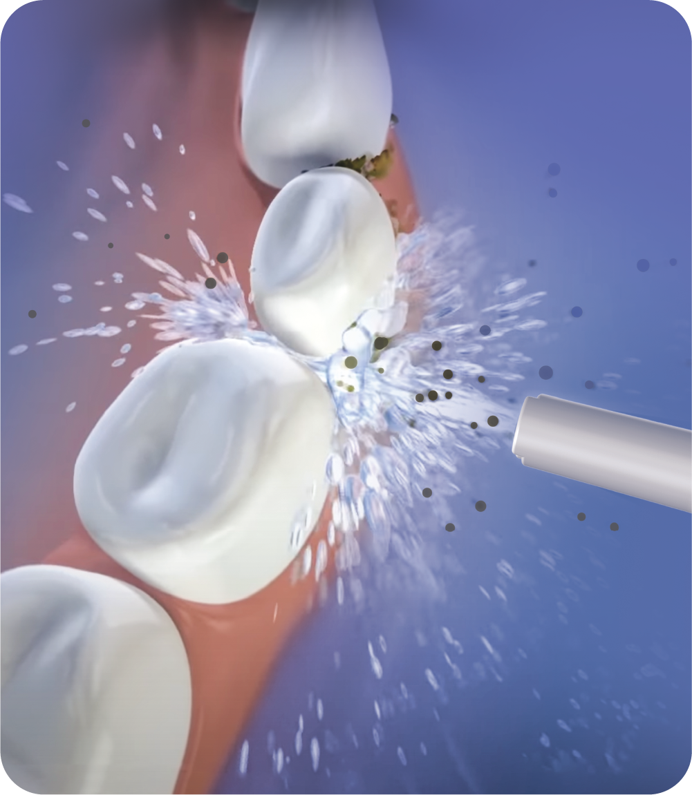 OC200 LITE Smart PLUS® Water Flosser